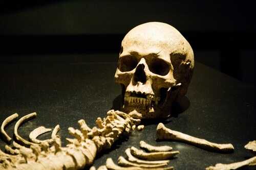 A human skull and skeletal remains displayed in a museum