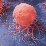 Cancer cells spreading on a blue surface.