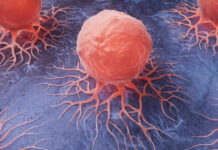 Cancer cells spreading on a blue surface.